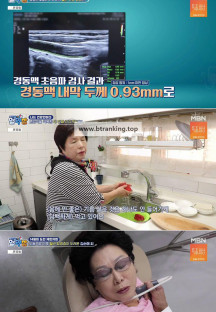 알약방.E231.241128.720p-NEXT